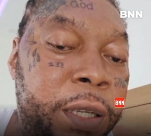 vybz kartel swollen face due to illness